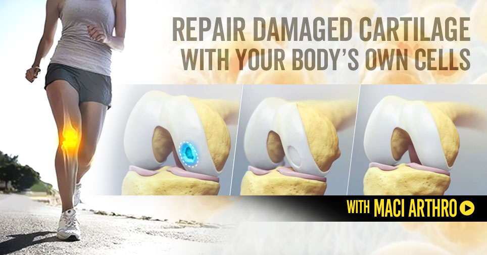 Repair Damaged Cartilage using your Body's own cells with MACi Arthro.