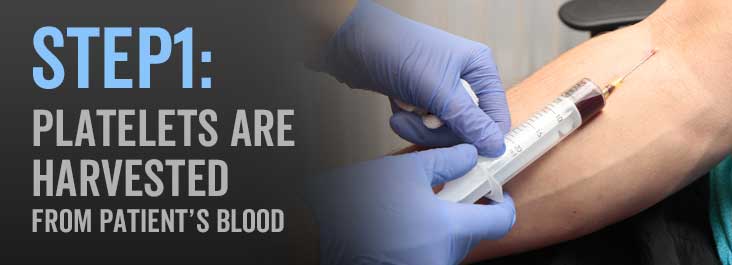 PRP step 1: Platelet harvesting