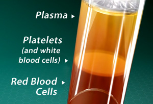 PRP Therapy offered by Panhandle Orthopaedics