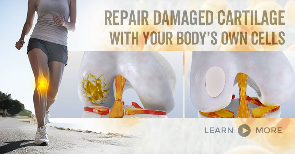 Repair damaged knee cartilage with your won cells through the MACI cartialge implant