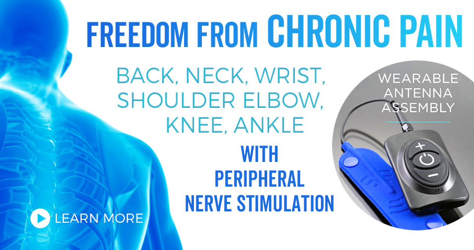 Relief from chronic pain with Stimwave nerve stimulators.
