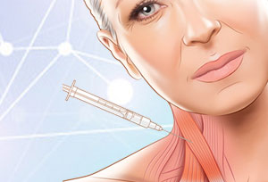 Xeomin Injection Therapy for Cervical Dystonia